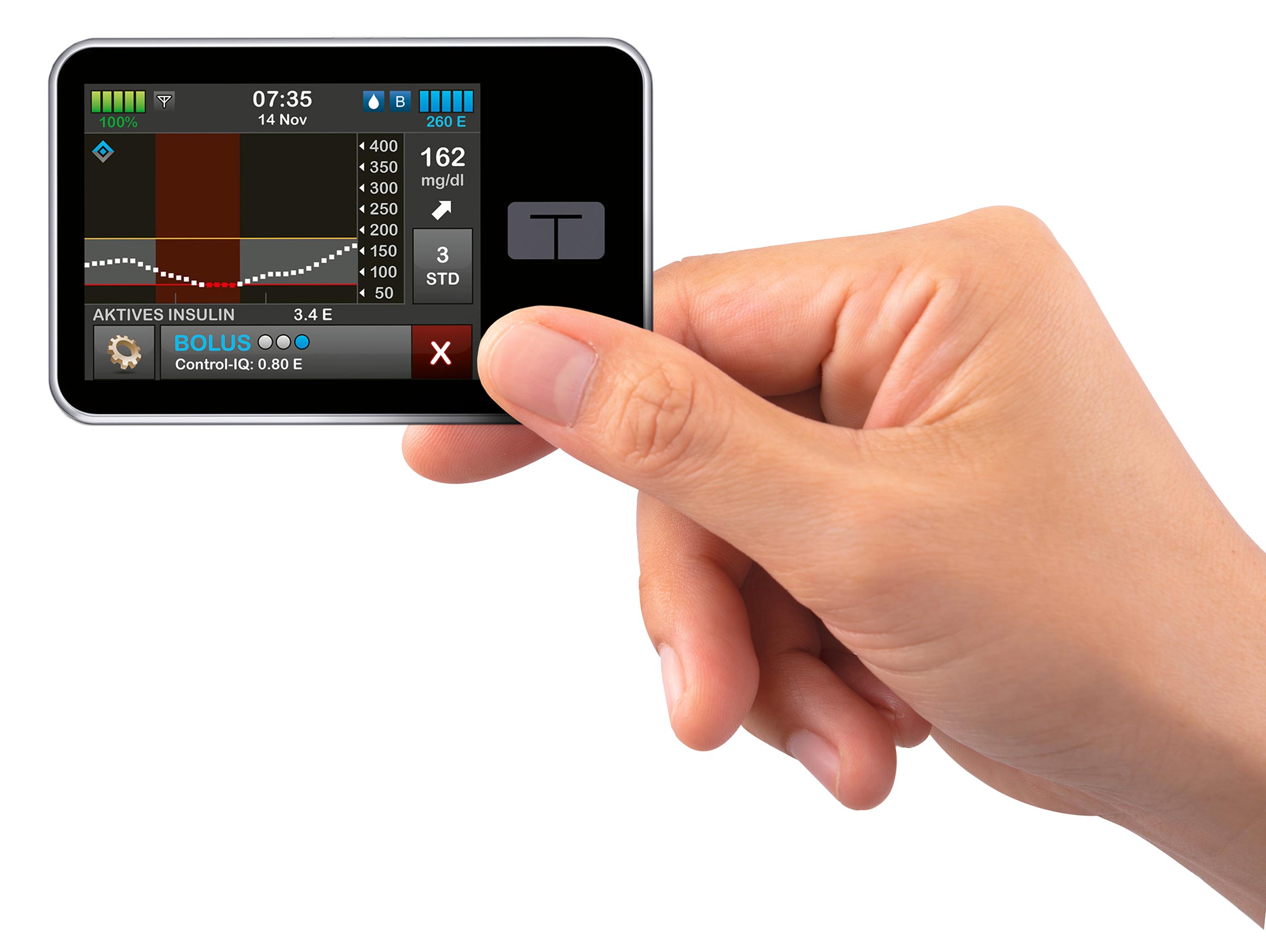 VitalAire - Diabetologie und Stoffwechsel Sonderdruck Thieme